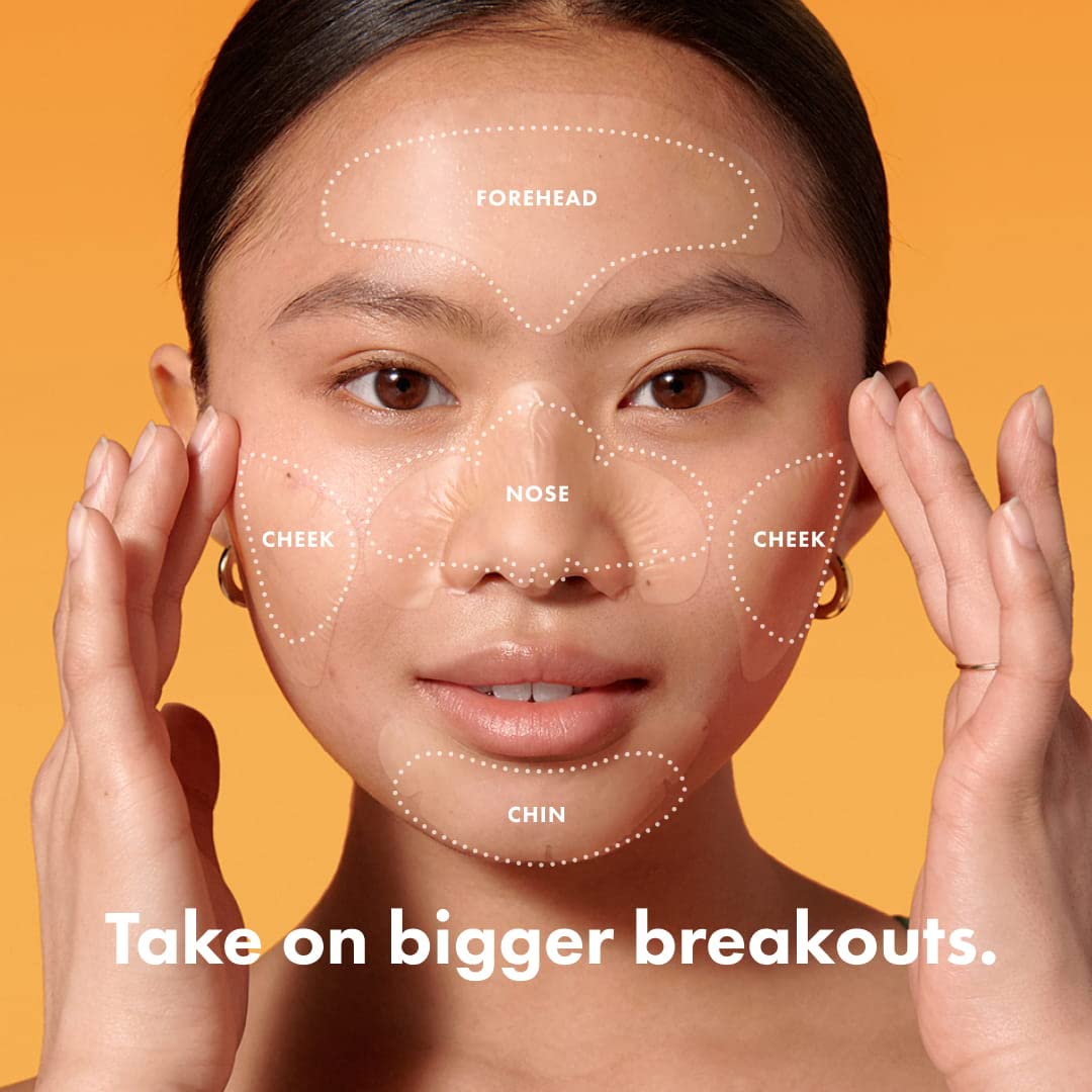 Hero Cosmetics Mighty Patch™ Face Patch - XL Hydrocolloid Face Mask for Acne, 5 Large Pimple Patches for Zit Breakouts on Nose, Chin, Forehead & Cheeks (1 Count)