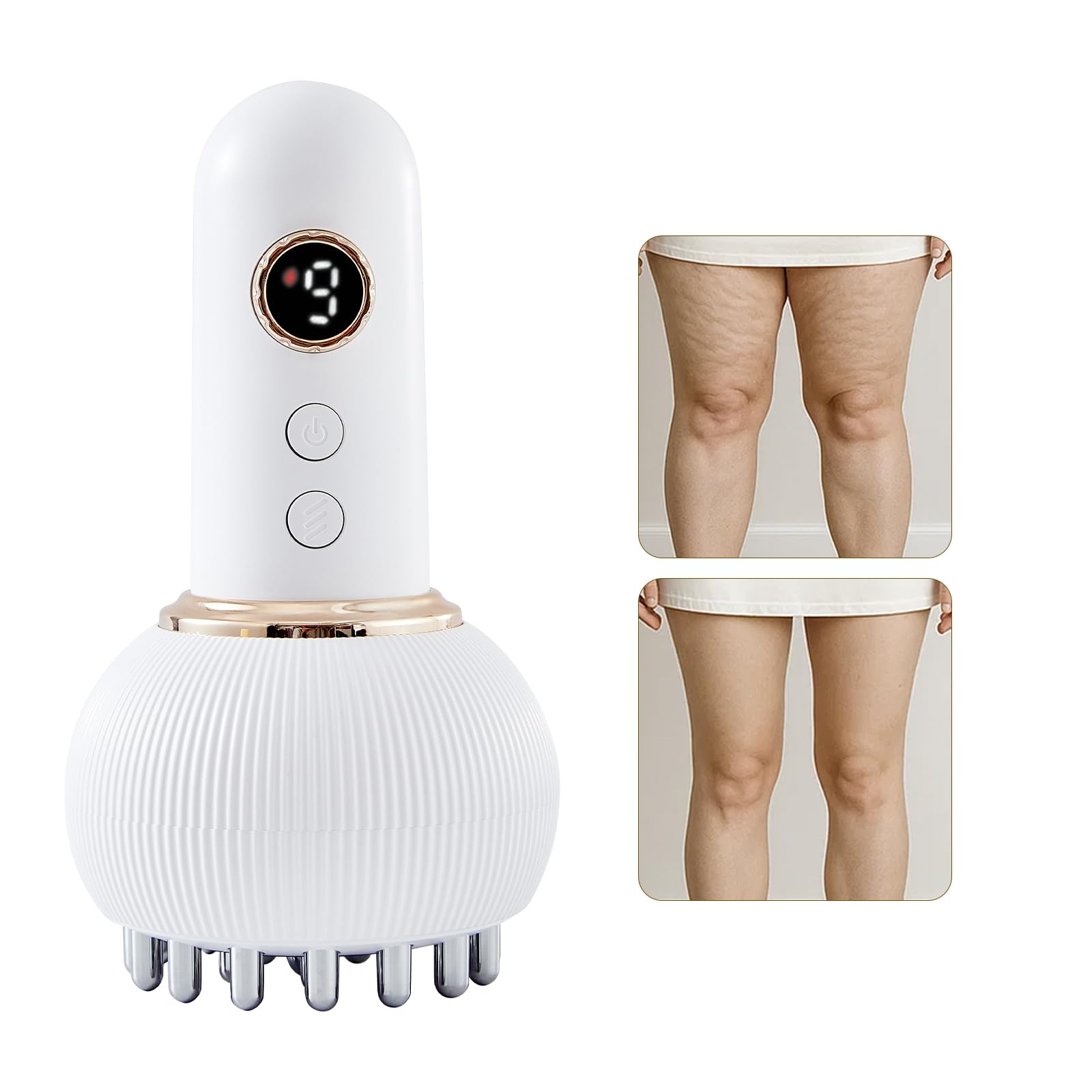 Yuonry Lymphatic Drainage Massager & Anti Cellulite Massage Tool, Helps Reduce Stretch Marks & Cellulite, for Legs, Arms & Belly, Body Sculpting Machine with Microcurrent, Light, Heat & Vibration