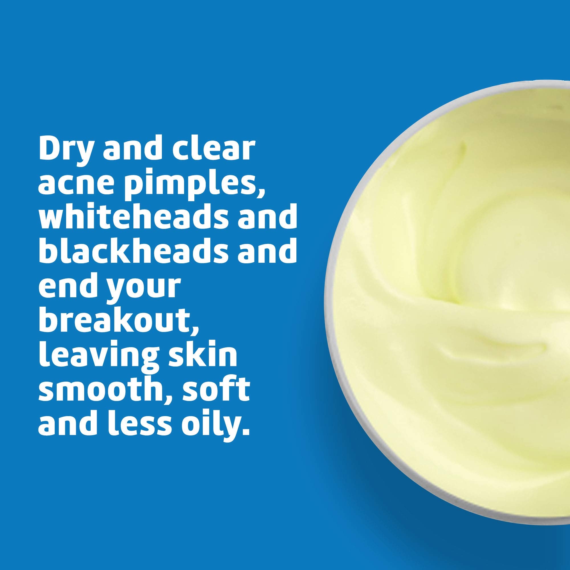 De La Cruz 10% Sulfur Ointment - Cystic Acne Treatment for Face and Body - Daily 10 Min Spot Treatment Mask - Safe and Effective Game Changing Hormonal Acne Treatment That Clears Up Pimples - 2.6 oz