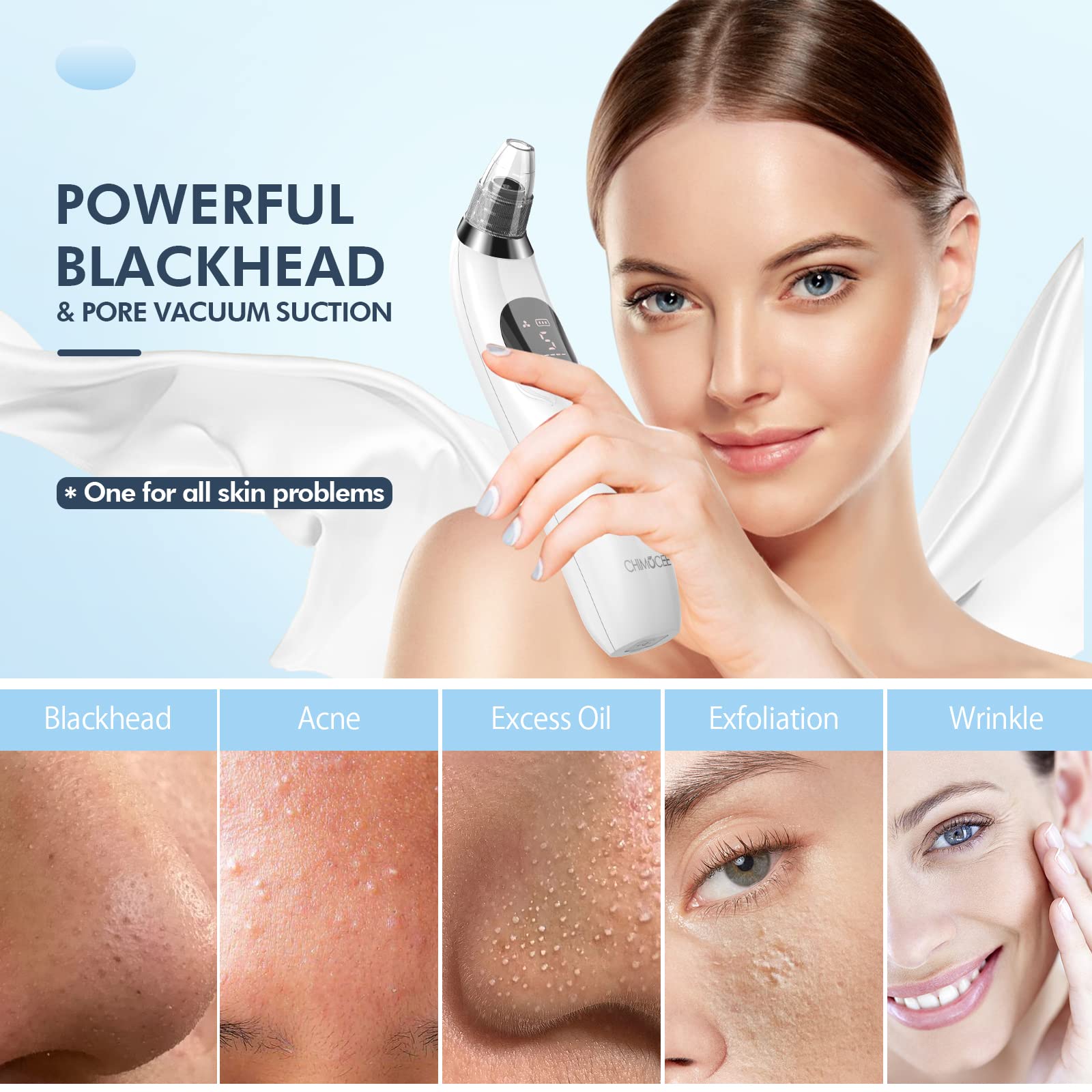 CHIMOCEE Blackhead Remover Pore Vacuum, Upgraded Black Head Remover for Face, Electric Acne Comedone Whitehead Extractor Tools-5 Suction Power, 5 Probes, USB Rechargeable Pimple Popper Tool Kit