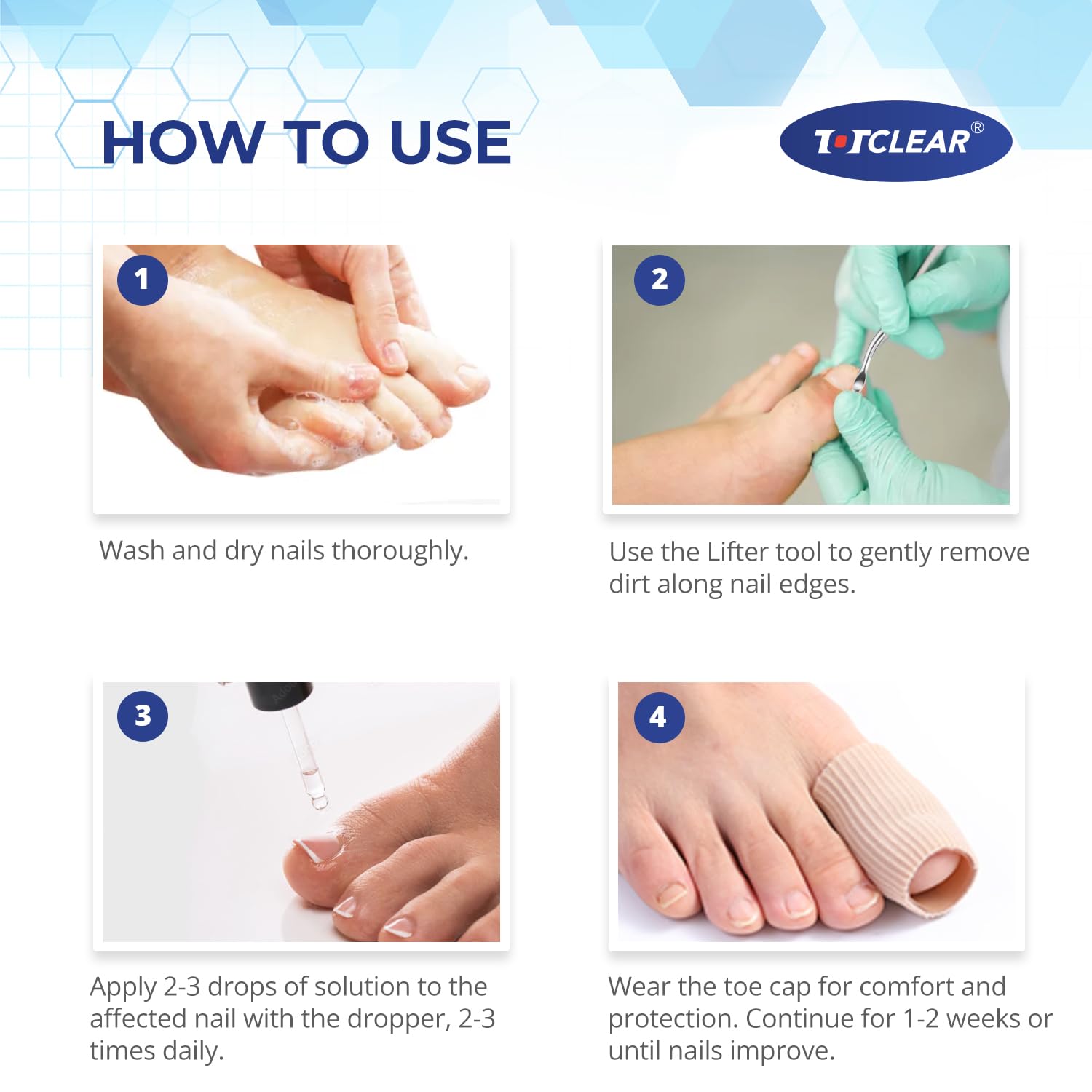 Ingrown Toenail Relief: Ingrown Toenail Tool for Men Women - Ingrown Toenail Removal Kit - Ingrown Toenail Corrector Drops - Ingrown Toenail Removal - Effective Solution for Ingrown Toenails - 30ml