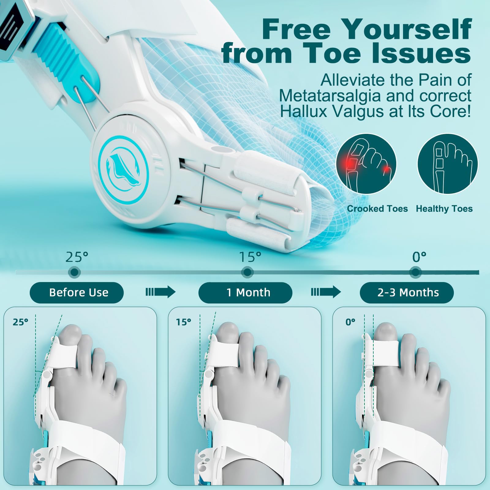 Kutain Upgraded Bunion Corrector for Women & Men, Orthopedic Bunions Correction with Non Slip Big Toe Separators, Adjustable Bunion Splint Suitable for Left/Right Feet Bunion Relief (1PCS)