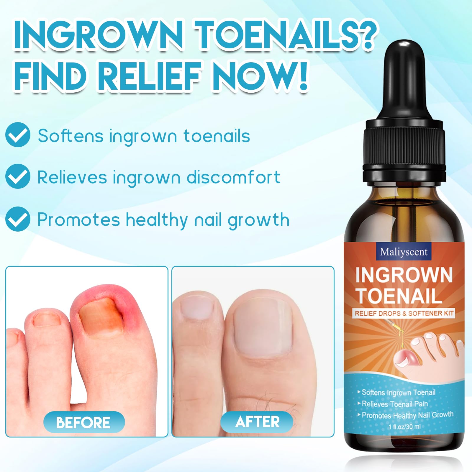 Ingrown Toenail Removal Kit, Professional Ingrown Toenail Tool Kit Includes Ingrown Toenail Corrector Drops, Corrector Patch, Toenail Clipper, Nail File Lifter Pedicure Tools