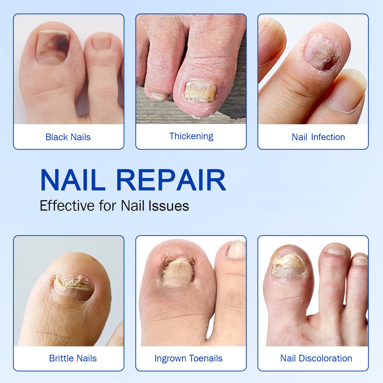Nail Patches 21 PCS Toenail Treatment Extra Strength 8-Hour Overnight Nail Fast Acting Repair Effortless Hydrogel Nail Care and Repair for Damaged Nails Overnight Renewal for Men and Women