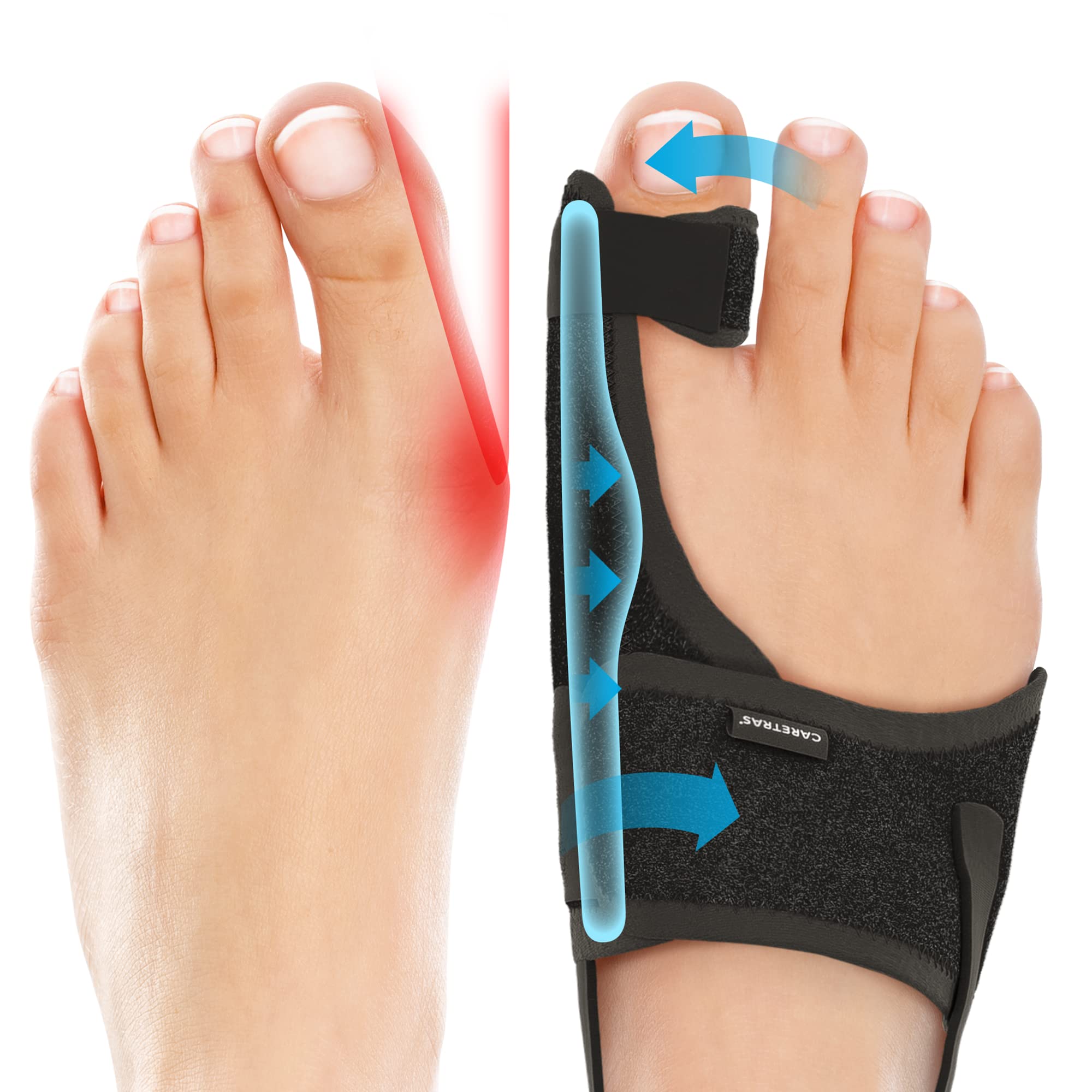 Caretras 2er-Pack Ballenzeh-Korrektor für Damen und Herren, orthopädische Ballenzeh-Schiene zur Linderung von Hallux Valgus Schmerzen, großer Zehentrenner, verstellbare Tag-/Nachtstütze, komfortabler Hammerzehen-Geraderichter
