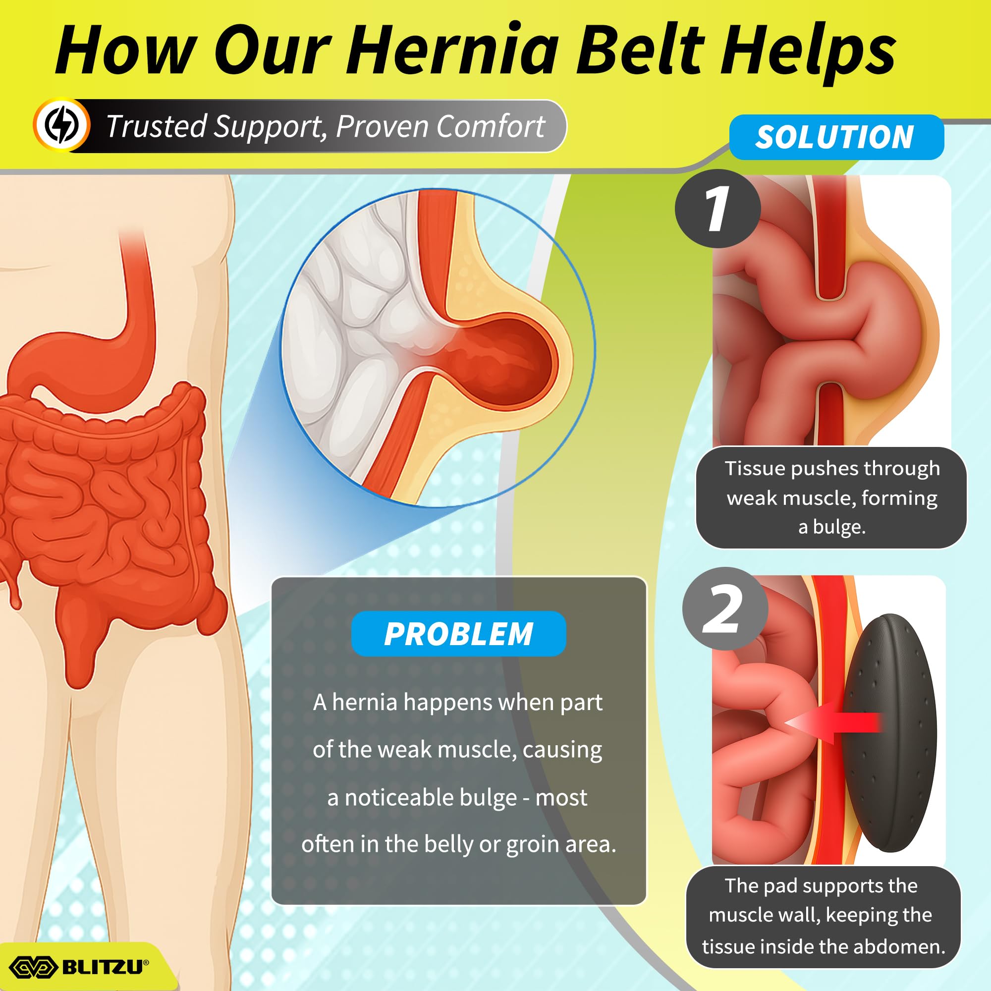 BLITZU Umbilical Hernia Belt for Men & Women, Abdominal Binder Adjustable Truss Support with 2 Compression Pads for Naval, Ventral, Incisional, Epigastric, Belly Button Hernias, Pre Post Surgery L-XL